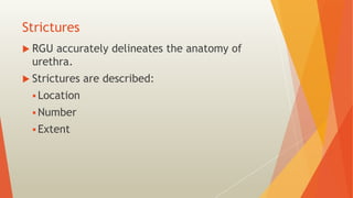 Utricular Cyst Rgu RGU and MCU – Procedure and interpretation in commonly encountered ...