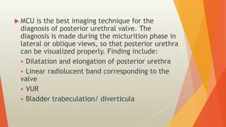 RGU and MCU – Procedure and interpretation in commonly encountered ...