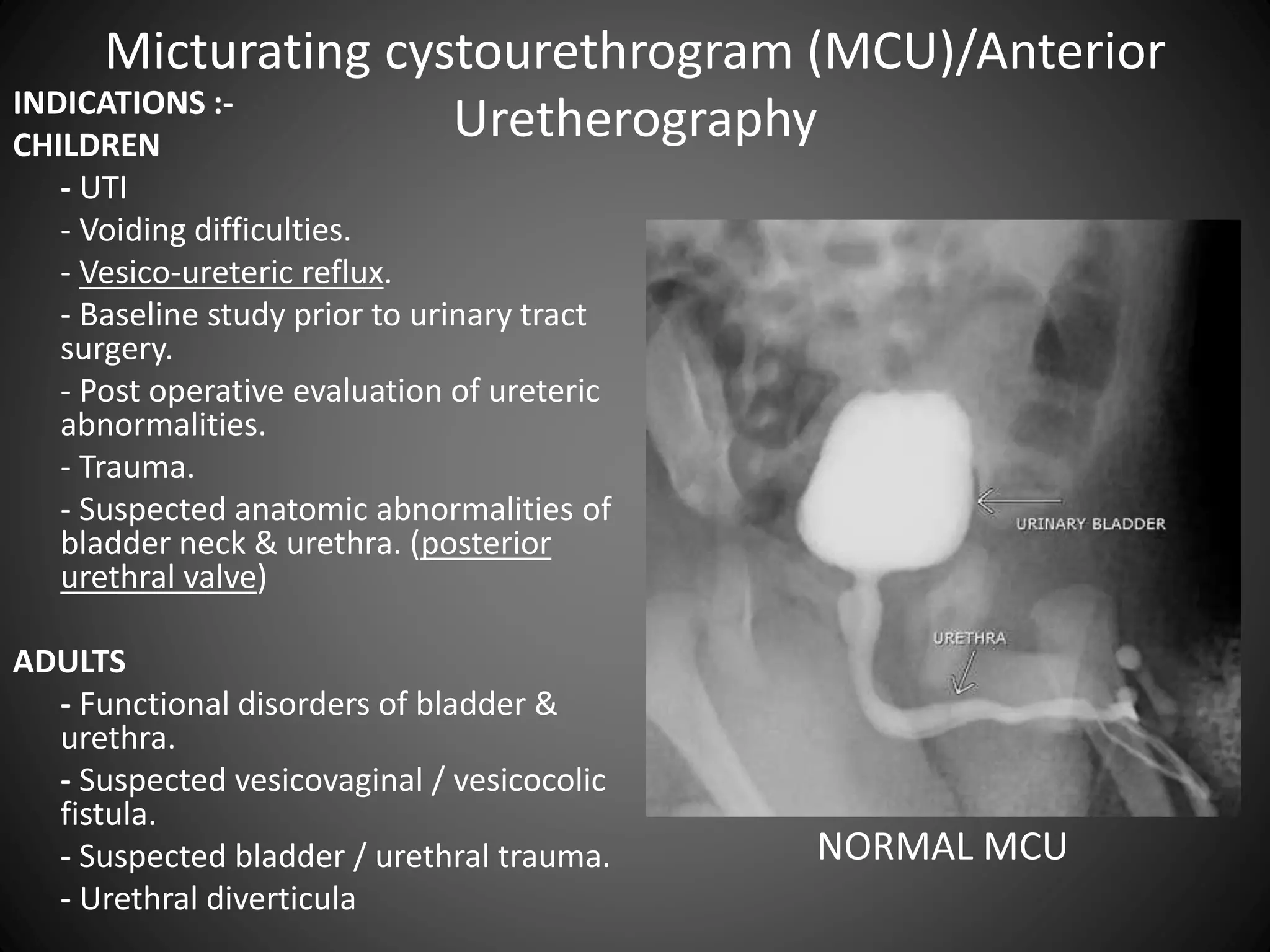 Anterograde/Retrograde urethrography (RGU/MCU) | PPTX