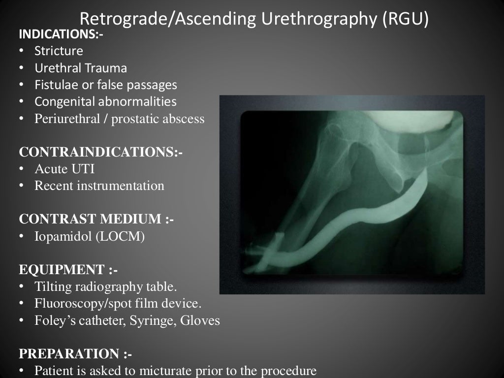 Anterograde/Retrograde urethrography (RGU/MCU)