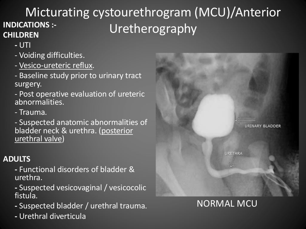 Anterograde/Retrograde urethrography (RGU/MCU)