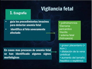 Vigilancia fetal guía los procedimientos invasivos para detectar anemia fetal identifica al feto severamente afectado polihidramnios Derrame pericardico Ascitis  edema fetal (hidropesía) En casos mas precoces de anemia fetal se han identificado algunos signos morfológicos  grosor placentario (> 4cm ) dilatación de la vena umbilical aumento del tamaño hepático o esplénico 1 . Ecografía 
