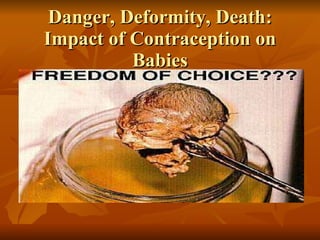 Danger, Deformity, Death: Impact of Contraception on Babies 