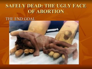 SAFELY DEAD: THE UGLY FACE OF ABORTION THE END GOAL 