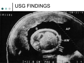 USG FINDINGS
 