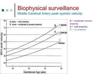 Biophysical surveillance
Middle Cerebral Artery peak systolic velocity
B = moderate-severe
anaemia
A = mild anaemia
C = no anaemia
C
 