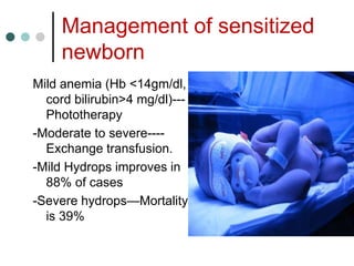 Management of sensitized
newborn
Mild anemia (Hb <14gm/dl,
cord bilirubin>4 mg/dl)---
Phototherapy
-Moderate to severe----
Exchange transfusion.
-Mild Hydrops improves in
88% of cases
-Severe hydrops—Mortality
is 39%
 