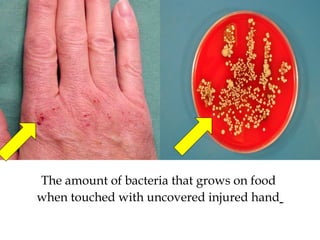 Rh 3 Hand Hygiene | PPT