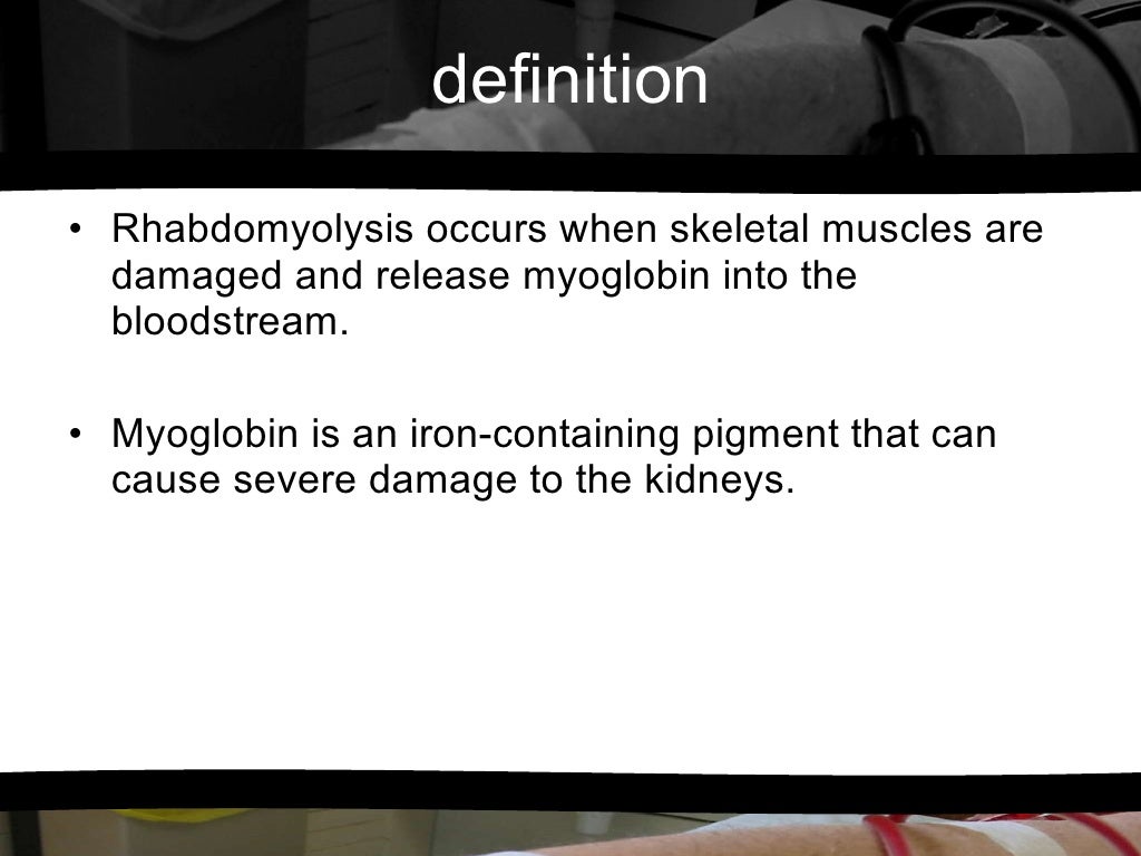 Rhabdomyolysis