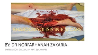 SUPERVISOR: DR ZAYUAH MAT SULAIMAN
BY: DR NORFARHANAH ZAKARIA
RHABDOMYOLISIS IN ICU CARE
 