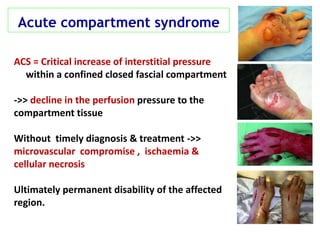 Acute compartment syndrome
ACS = Critical increase of interstitial pressure
within a confined closed fascial compartment
->> decline in the perfusion pressure to the
compartment tissue
Without timely diagnosis & treatment ->>
microvascular compromise , ischaemia &
cellular necrosis
Ultimately permanent disability of the affected
region.
 