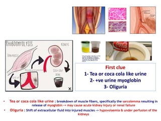 • Tea or coca cola like urine : breakdown of muscle fibers, specifically the sarcolemma resulting in
release of myoglobin -> may cause acute kidney injury or renal failure
• Oliguria : Shift of extracellular fluid into injured muscles -> hypovolaemia & under perfusion of the
kidneys
First clue
1- Tea or coca cola like urine
2- +ve urine myoglobin
3- Oliguria
 