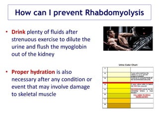 How can I prevent Rhabdomyolysis
• Drink plenty of fluids after
strenuous exercise to dilute the
urine and flush the myoglobin
out of the kidney
• Proper hydration is also
necessary after any condition or
event that may involve damage
to skeletal muscle
 