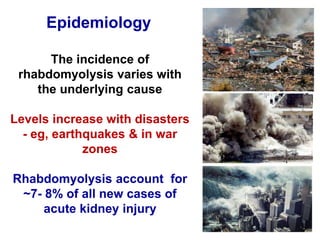 The incidence of
rhabdomyolysis varies with
the underlying cause
Levels increase with disasters
- eg, earthquakes & in war
zones
Rhabdomyolysis account for
~7- 8% of all new cases of
acute kidney injury
Epidemiology
 