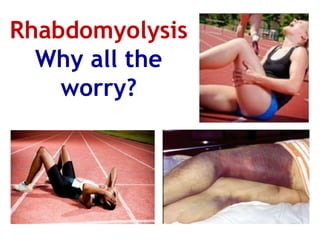 Rhabdomyolysis
Why all the
worry?
 