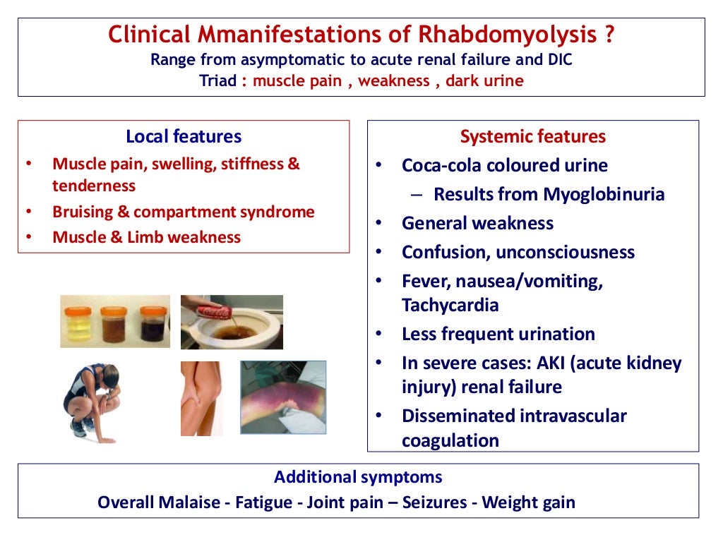 Rhabdomyolysis