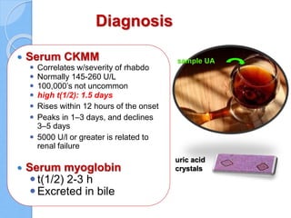 Diagnosis
 Serum CKMM
 Correlates w/severity of rhabdo
 Normally 145-260 U/L
 100,000’s not uncommon
 high t(1/2): 1.5 days
 Rises within 12 hours of the onset
 Peaks in 1–3 days, and declines
3–5 days
 5000 U/l or greater is related to
renal failure
 Serum myoglobin
t(1/2) 2-3 h
Excreted in bile
sample UA
uric acid
crystals
 