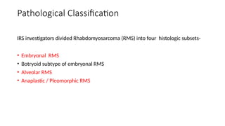 Pleomorphic Rms management of the Rhabdomyosarcoma.pptx