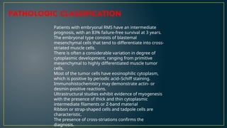 Embryonal Rms Rhabdomyosarcoma (RMS) is a highly malignant soft tissue sarcoma | PPTX