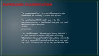 Rhabdomyosarcoma (RMS) is a highly malignant soft tissue sarcoma | PPTX