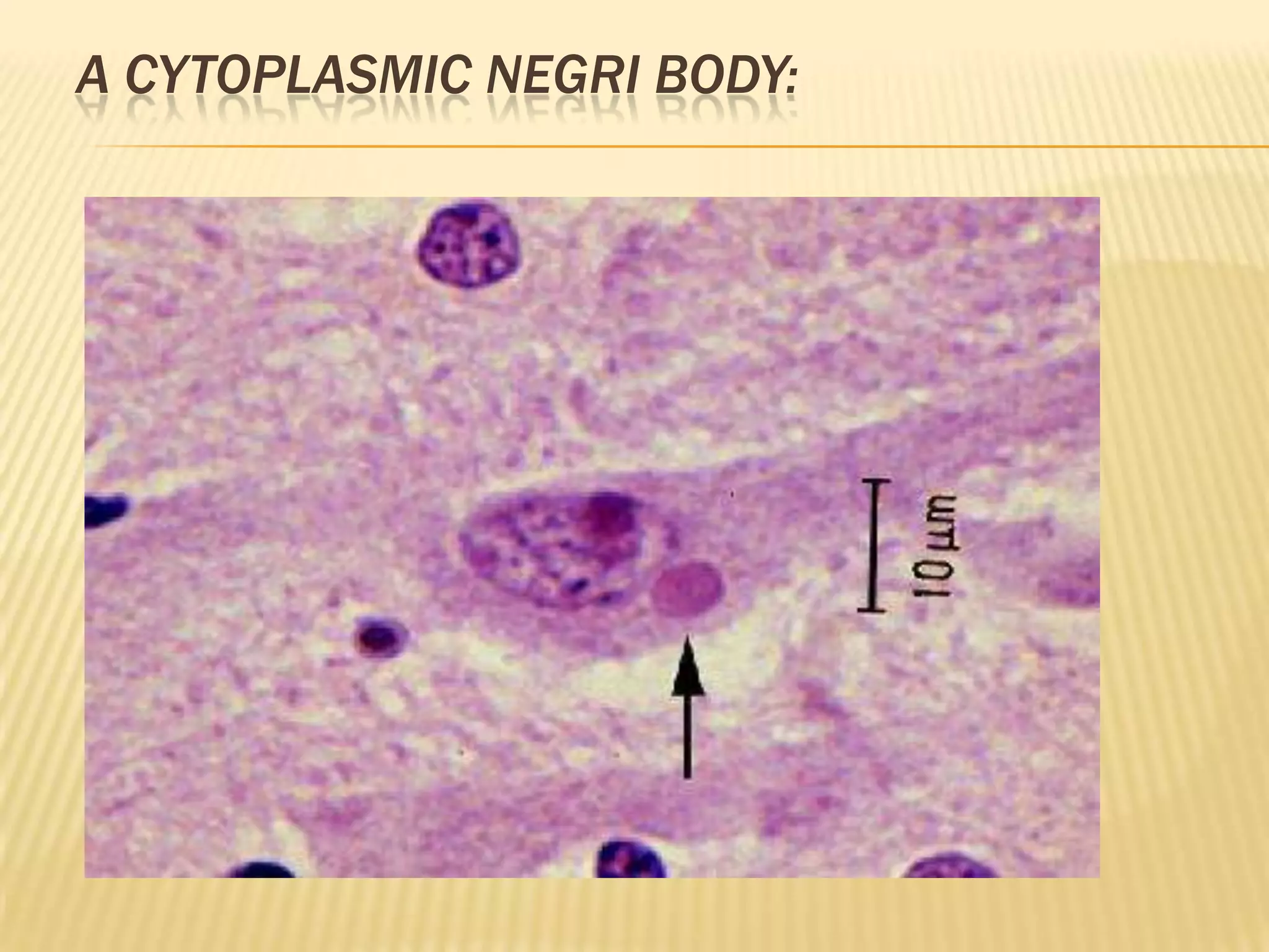 A CYTOPLASMIC NEGRI BODY:
 