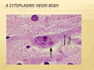 A CYTOPLASMIC NEGRI BODY:
 