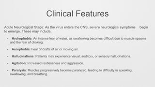 Clinical Features
Acute Neurological Stage: As the virus enters the CNS, severe neurologica symptoms begin
to emerge. These may include:
• Hydrophobia: An intense fear of water, as swallowing becomes difficult due to muscle spasms
and the fear of choking.
• Aerophobia: Fear of drafts of air or moving air.
• Hallucinations: Patients may experience visual, auditory, or sensory hallucinations.
• Agitation: Increased restlessness and aggression.
• Paralysis: Muscles progressively become paralyzed, leading to difficulty in speaking,
swallowing, and breathing.
 