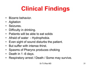Clinical Findings
• Bizarre behavior.
• Agitation
• Seizures.
• Difficulty in drinking.
• Patients will be able to eat solids
• Afraid of water - Hydrophobia.
• Even sight of sound disturbs the patient.
• But suffer with intense thirst.
• Spasms of Pharynx produces choking
• Death in 1 -6 days.
• Respiratory arrest / Death / Some may survive.
Dr.T.V.Rao MD 31
 