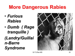 More Dangerous Rabies
• Furious
Rabies
• Dumb ( Rage
tranquille )
(Landry/Guillai
n-Barre
Syndrome
Dr.T.V.Rao MD 35
 
