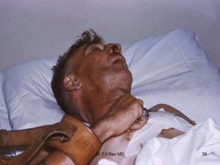 Dr.T.V.Rao MD 38
 