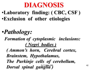 DIAGNOSIS
•Laboratory finding: ( CBC, CSF )
•Exclusion of other etiologies
•Pathology:
Formation of cytoplasmic inclusions:
( Negri bodies )
( Ammon’s horn, Cerebral cortex,
Brainstem, Hypothalamus,
The Purkinje cells of cerebellum,
Dorsal spinal ganglia )
Dr.T.V.Rao MD 42
 