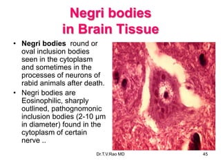 Negri bodies
in Brain Tissue
• Negri bodies round or
oval inclusion bodies
seen in the cytoplasm
and sometimes in the
processes of neurons of
rabid animals after death.
• Negri bodies are
Eosinophilic, sharply
outlined, pathognomonic
inclusion bodies (2-10 µm
in diameter) found in the
cytoplasm of certain
nerve ..
Dr.T.V.Rao MD 45
 