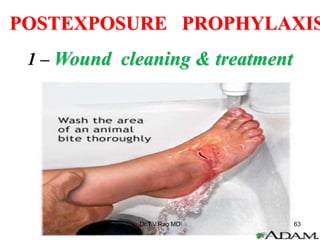 POSTEXPOSURE PROPHYLAXIS
1 – Wound cleaning & treatment
Dr.T.V.Rao MD 63
 
