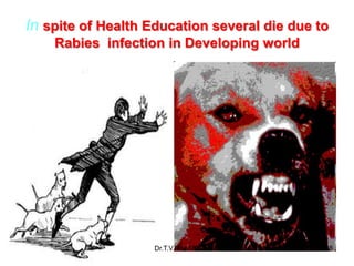 In spite of Health Education several die due to
Rabies infection in Developing world
Dr.T.V.Rao MD 68
 