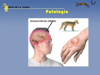 Patología  VIRUS DE LA  RABIA 