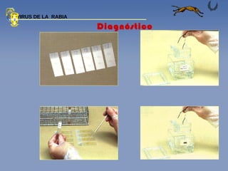 Diagnóstico  VIRUS DE LA  RABIA 