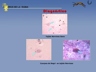 Tejido Nervioso Sano Cuerpos de Negri  en tejido Nervioso  Diagnóstico  VIRUS DE LA  RABIA 