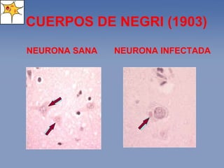 CUERPOS DE NEGRI ( 1903 ) NEURONA INFECTADA NEURONA SANA 