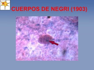CUERPOS DE NEGRI ( 1903 ) 