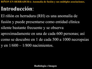 RIÑON EN HERRADURA: Anomalía de fusión y sus múltiples asociaciones.


Introducción:
El riñón en herradura (RH) es una ano...