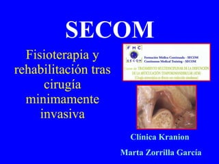 SECOM Fisioterapia y rehabilitación tras cirugía minimamente invasiva Clínica Kranion Marta Zorrilla García 