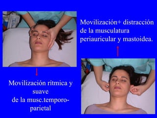 Movilización rítmica y suave de la musc.temporo-parietal Movilización+ distracción de la musculatura periauricular y mastoidea. 