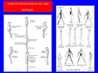 Aspectos biomecánicos de cada tipología   