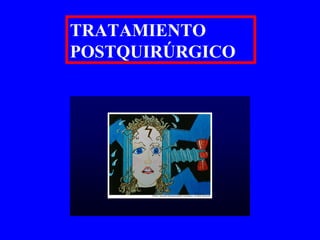 TRATAMIENTO POSTQUIRÚRGICO 