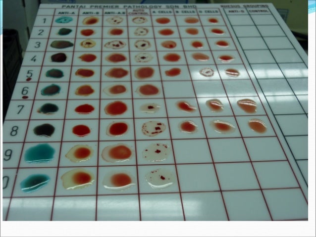 rh blood group ss