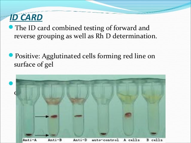 rh blood group ss