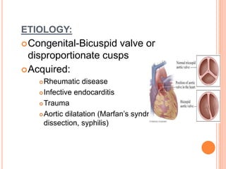 Rhd RHD- Rheumatic Heart Disease , VHD - Valvular Heart Disease | PPTX