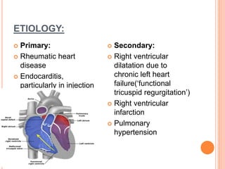 Patofisiologi Rhd RHD- Rheumatic Heart Disease , VHD - Valvular Heart Disease | PPTX