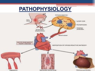 PATHOPHYSIOLOGY
 