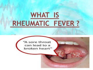 WHAT IS
RHEUMATIC FEVER ?
 
